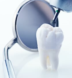 Dentistry tools with a white teeth