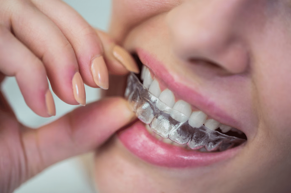 woman holding clear mouthguard on mouth